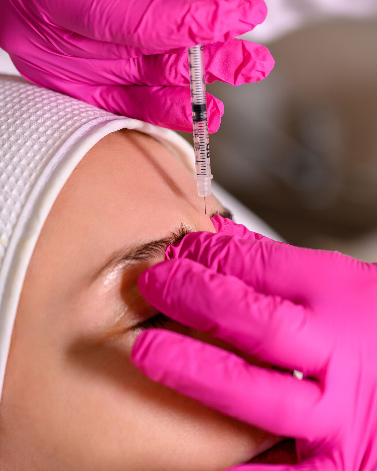 Εφαρμογή θεραπείας Botox στο μεσόφρυο γυναίκας στο κέντρο αισθητικής Skin Lux στο Περιστέρι